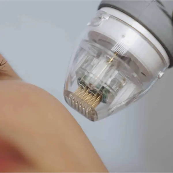 aparatologia radiofrecuencia fraccionada