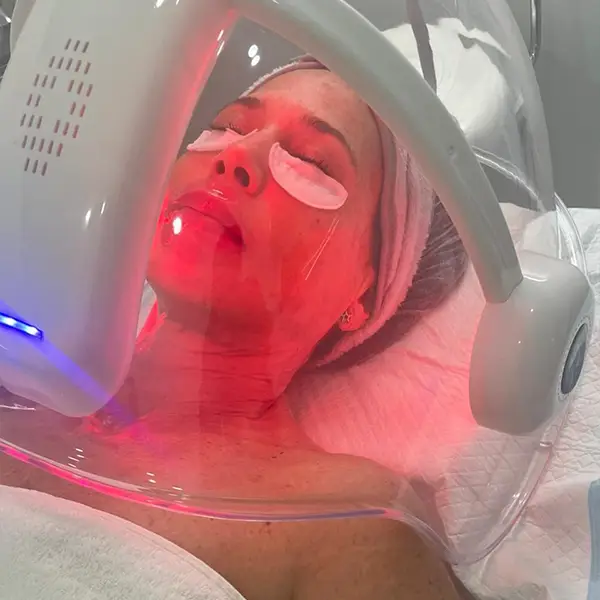 faciales oxigenoterapia